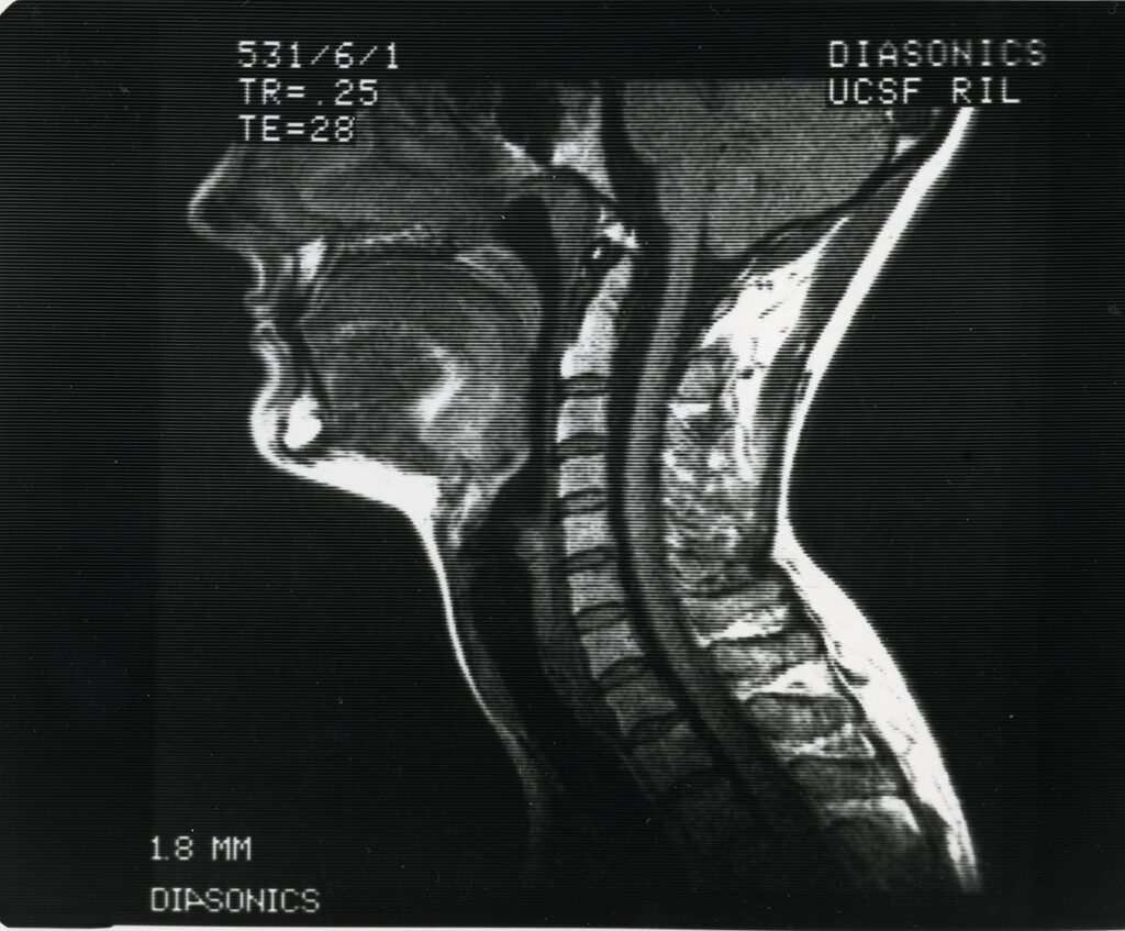 Image of MRI scan prepared for scientific publications and sales meetings, circa 1985, RIL records, MSS 2002-08